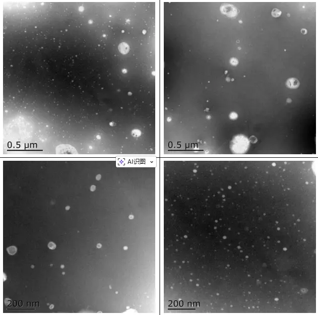 TEM lipo VC TEM lipo VC